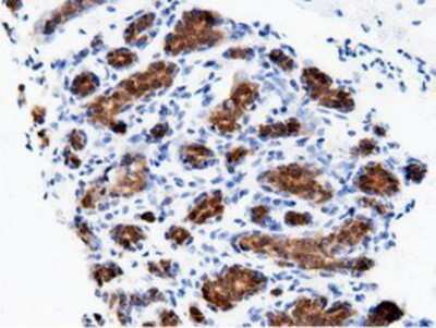 Immunohistochemistry-Paraffin: AK5 Antibody (OTI2F9) [NBP2-02978]