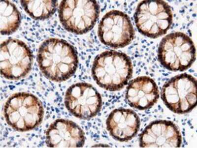 Immunohistochemistry-Paraffin: AK5 Antibody (OTI2F9) [NBP2-02978]