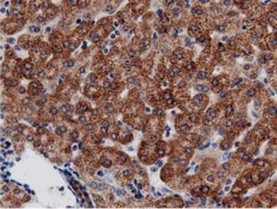 Immunohistochemistry-Paraffin: AK5 Antibody (OTI2F9) [NBP2-02978]