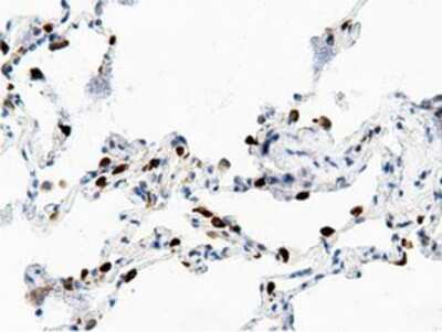 Immunohistochemistry-Paraffin: AK5 Antibody (OTI2F9) [NBP2-02978]