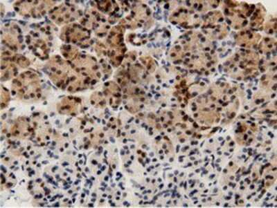 Immunohistochemistry-Paraffin: AK5 Antibody (OTI2F9) [NBP2-02978]
