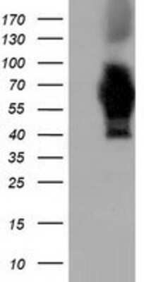 Western Blot: AK5 Antibody (OTI2F9) [NBP2-02978]