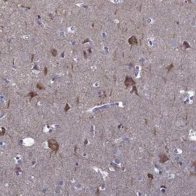 Immunohistochemistry-Paraffin: AK5 Antibody [NBP1-89453]
