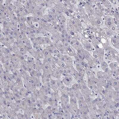 Immunohistochemistry-Paraffin: AK5 Antibody [NBP1-89453]