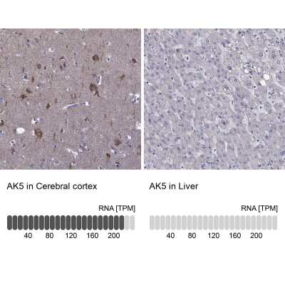 Immunohistochemistry-Paraffin: AK5 Antibody [NBP1-89453]