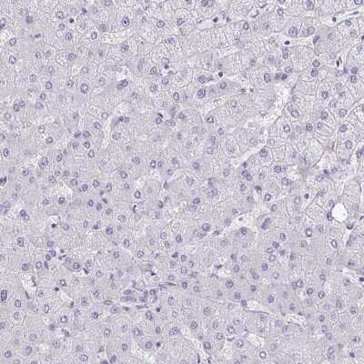 Immunohistochemistry-Paraffin: AK5 Antibody [NBP2-33821]
