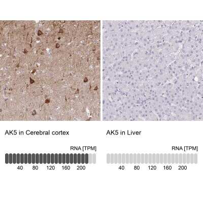 Immunohistochemistry-Paraffin: AK5 Antibody [NBP2-33821]