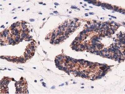 Immunohistochemistry: AK5 Antibody (OTI2F9) - Azide and BSA Free [NBP2-71813]