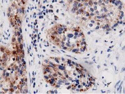 Immunohistochemistry: AK5 Antibody (OTI2F9) - Azide and BSA Free [NBP2-71813]