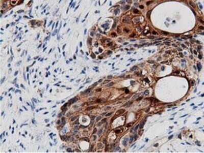 Immunohistochemistry: AK5 Antibody (OTI2F9) - Azide and BSA Free [NBP2-71813]