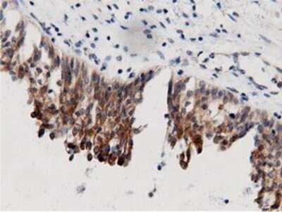 Immunohistochemistry: AK5 Antibody (OTI2F9) - Azide and BSA Free [NBP2-71813]