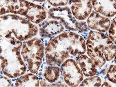 Immunohistochemistry: AK5 Antibody (OTI2F9) - Azide and BSA Free [NBP2-71813]