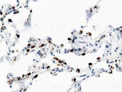 Immunohistochemistry: AK5 Antibody (OTI2F9) - Azide and BSA Free [NBP2-71813]