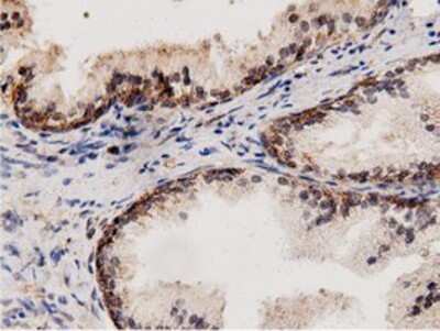 Immunohistochemistry: AK5 Antibody (OTI2F9) - Azide and BSA Free [NBP2-71813]