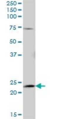 Western Blot: AK5 Antibody [H00026289-B01P]