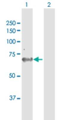 Western Blot: AK5 Antibody [H00026289-B01P]