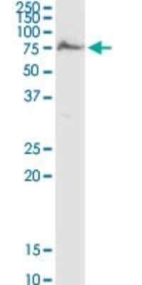 Western Blot: AK5 Antibody [H00026289-D01P]