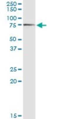 Western Blot: AK5 Antibody [H00026289-D01P]