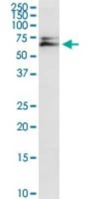 Western Blot: AK5 Antibody [H00026289-D01P]