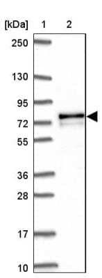 Western Blot: AK5 Antibody [NBP2-33821]