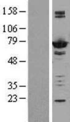 Western Blot: AK5 Overexpression Lysate [NBL1-07422]