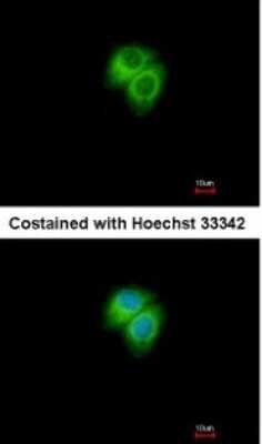 Immunocytochemistry/ Immunofluorescence: AK7 Antibody [NBP1-32560]