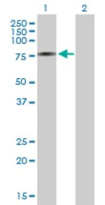 Western Blot: AK7 Antibody [H00122481-B01P]