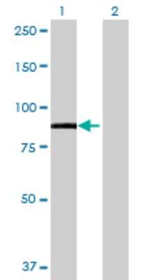 Western Blot: AK7 293T Cell Transient Overexpression Lysate [H00122481-T01]