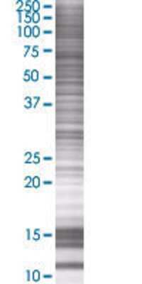 Western Blot: AK7 293T Cell Transient Overexpression Lysate [H00122481-T01]