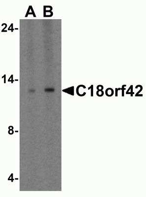 Western Blot: AKAIN1 AntibodyBSA Free [NBP2-81698]