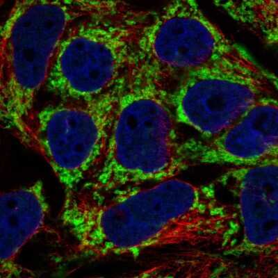 Immunocytochemistry/ Immunofluorescence: AKAP1 Antibody [NBP2-58918]