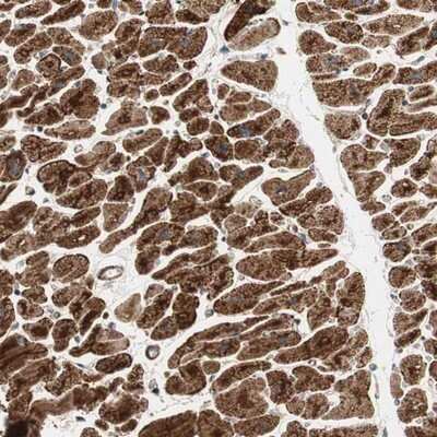 Immunohistochemistry-Paraffin: AKAP1 Antibody [NBP1-89172]