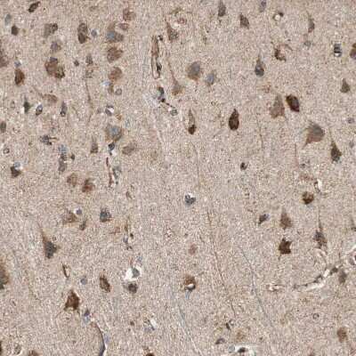 Immunohistochemistry-Paraffin: AKAP1 Antibody [NBP1-89172]