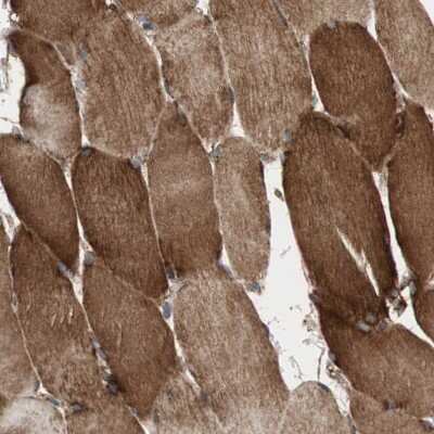 Immunohistochemistry-Paraffin: AKAP1 Antibody [NBP1-89172]