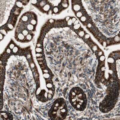 Immunohistochemistry-Paraffin: AKAP1 Antibody [NBP1-89172]