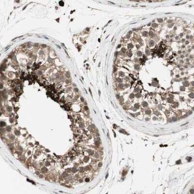 Immunohistochemistry-Paraffin: AKAP1 Antibody [NBP1-89172]