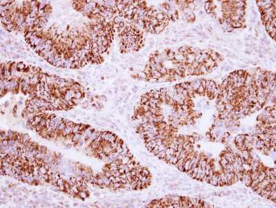 Immunohistochemistry-Paraffin: AKAP1 Antibody [NBP2-15319]