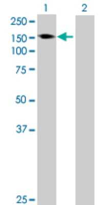 Western Blot: AKAP1 Antibody [H00008165-B01P]