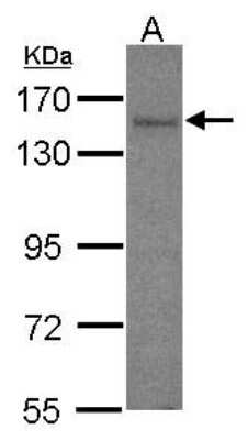Western Blot: AKAP1 Antibody [NBP1-33629]