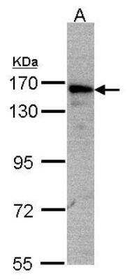 Western Blot: AKAP1 Antibody [NBP1-33629]