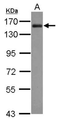 Western Blot: AKAP1 Antibody [NBP2-15319]