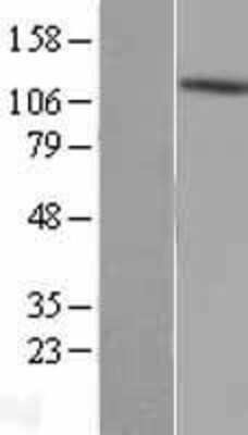 Western Blot: AKAP1 Overexpression Lysate [NBL1-07424]