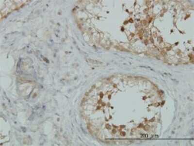 Immunohistochemistry-Paraffin: AKAP10 Antibody (8C10) [H00011216-M04]