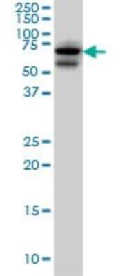 Western Blot: AKAP10 Antibody (8C10) [H00011216-M04]