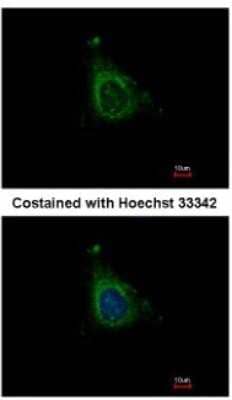 Immunocytochemistry/ Immunofluorescence: AKAP10 Antibody [NBP1-31483]