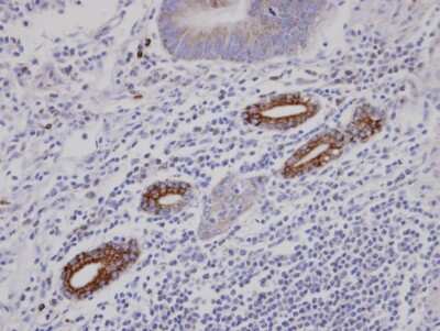 Immunohistochemistry-Paraffin: AKAP10 Antibody [NBP1-31483]