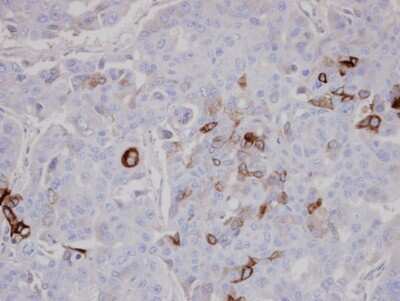 Immunohistochemistry-Paraffin: AKAP10 Antibody [NBP1-31483]