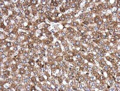 Immunohistochemistry-Paraffin: AKAP10 Antibody [NBP1-31483]