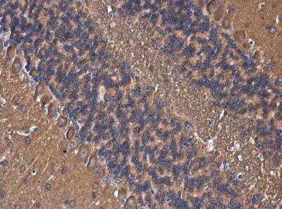 Immunohistochemistry-Paraffin: AKAP10 Antibody [NBP1-31483]