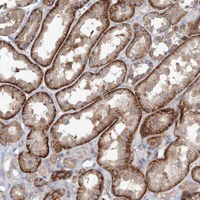Immunohistochemistry-Paraffin: AKAP10 Antibody [NBP1-85314]